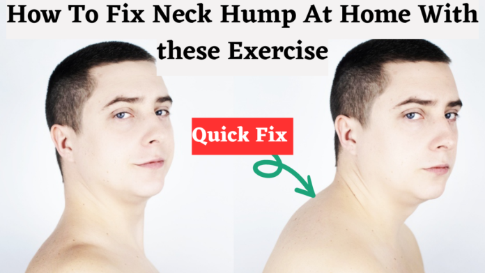 neck hump